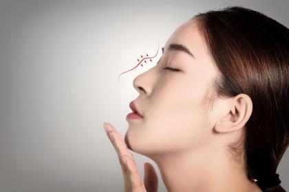 鼻樑上有痣的運勢好不好